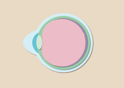 Keratoconus, illustration