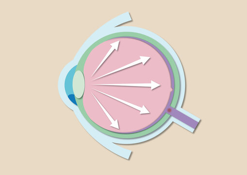 High eye pressure, conceptual illustration