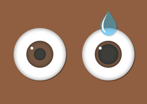 Eye dilation, illustration