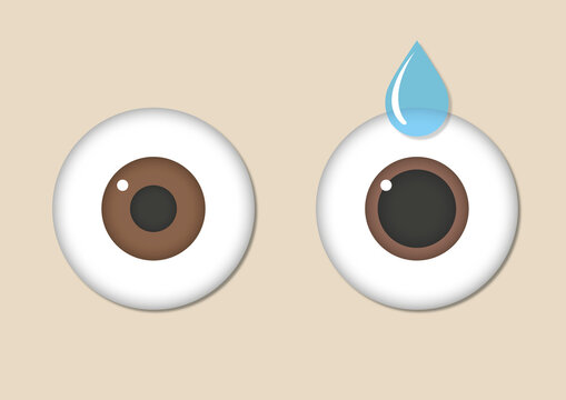 Eye dilation, illustration