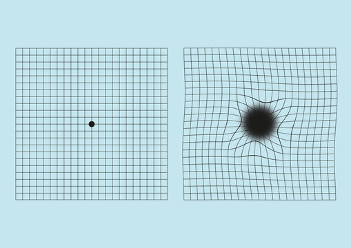 Amsler grid vision test, illustration