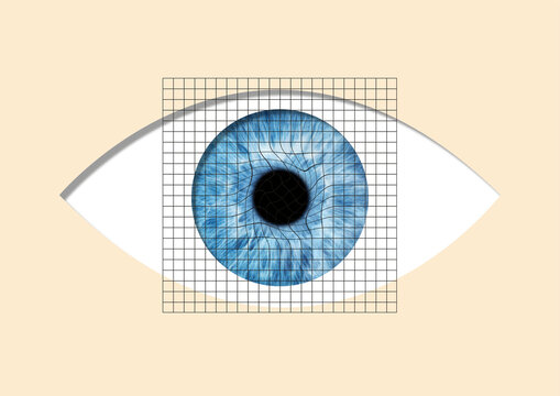 Amsler grid, conceptual illustration
