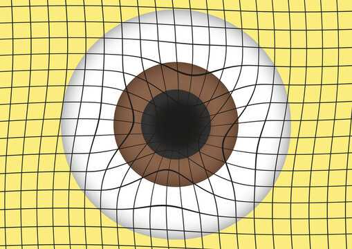 Amsler grid, conceptual illustration