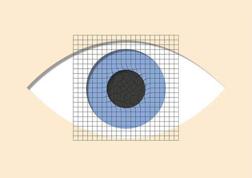 Amsler grid, conceptual illustration