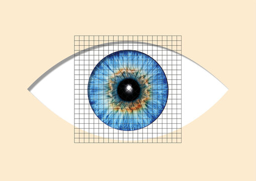 Amsler grid, conceptual illustration