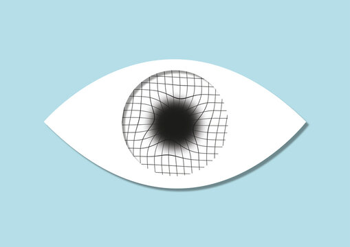 Amsler grid eye test, conceptual illustration