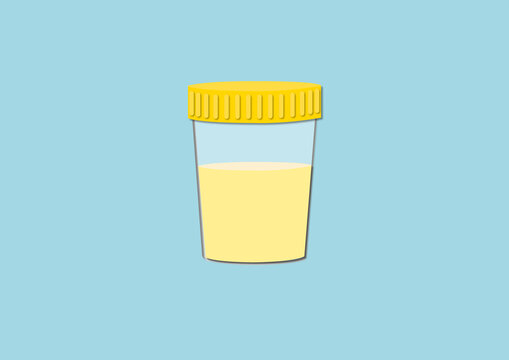 Urine sample, conceptual illustration