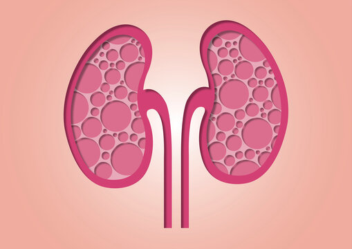 Kidney disease, conceptual illustration
