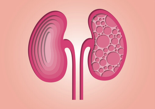 Kidney disease, conceptual illustration