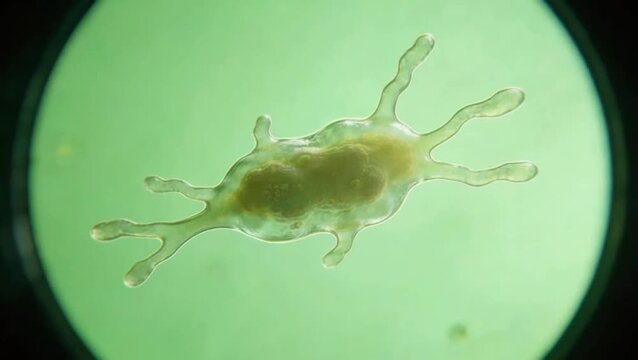 Amoeba under a microscope