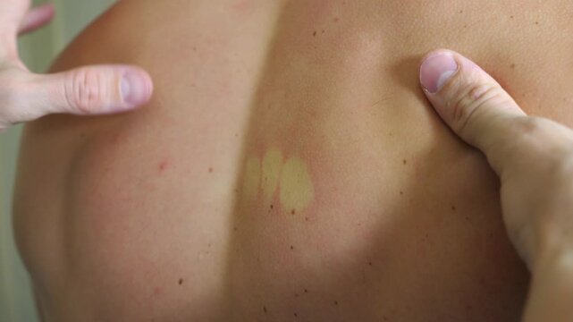 Close-up sequence of hands performing a therapeutic massage on a bare back, showcasing the gradual pressure application and relaxation of muscles in a soothing environment