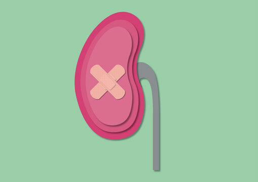 Kidney disease, conceptual illustration