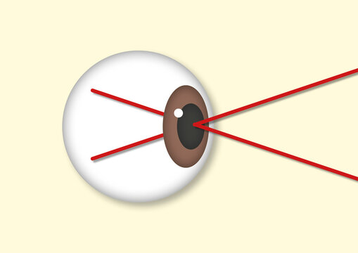 Laser eye surgery, conceptual illustration