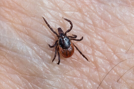 Castor bean tick (Ixodes ricinus) on human skin, Bavaria, Germany. July. 