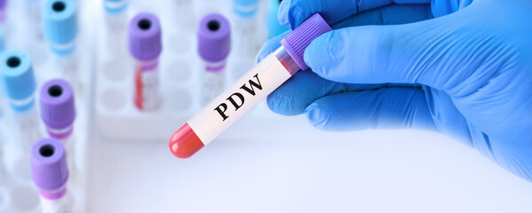 Obraz premium Doctor Holding RDW Blood Test Tube Explaining Red Cell Distribution Width for Anemia Diagnosis, Complete Blood Count Analysis in Clinical Laboratory, Medical Concept