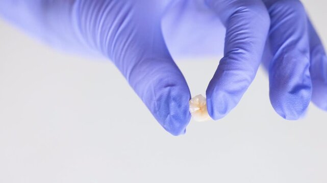 Artificial dental tooth held between fingers of dentist demonstrating prosthetic element for tooth replacement precision dentistry and clinical dental restoration concept
