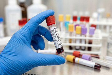 Naklejka premium Gloved hand holding a blood sample tube for a pertussis test in a laboratory