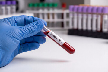 Fototapeta premium Gloved hand holding blood sample tube for a bacterial test in a lab