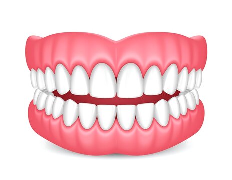 Animated dental illustration of upper and lower teeth set on pink gums
