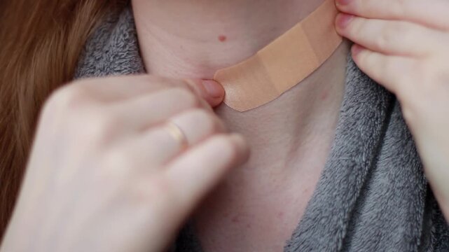 A young woman peels off a bandage on her scar on her neck after having a mole removed