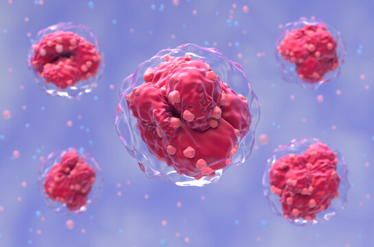 Acute lymphocytic leukemia (ALL) cells in blood flow - semi closeup view 3d illustration