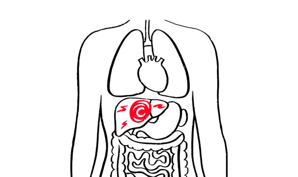 Liver disease concept