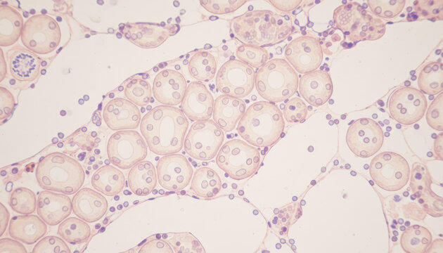 Liver triglyceride storage in microscopic cells shows detailed round structures with purple nuclei and clear cytoplasm under light microscope