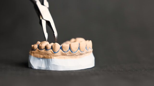 Plaster upper jaw model held by dental bayonet instrument on black background showing orthodontic handling precise placement and professional dental training setup