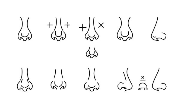 Rhinoplasty outline icon set with nose correction and cosmetic surgery symbols for web design isolated on white
