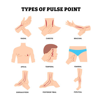 Different types of pulse point location. Labeled radial, carotid, brachial, apical, temporal, femoral, dorsalis pedis, posterior tibial, popliteal. Artery area heart beat. Assessing Peripheral Pulses