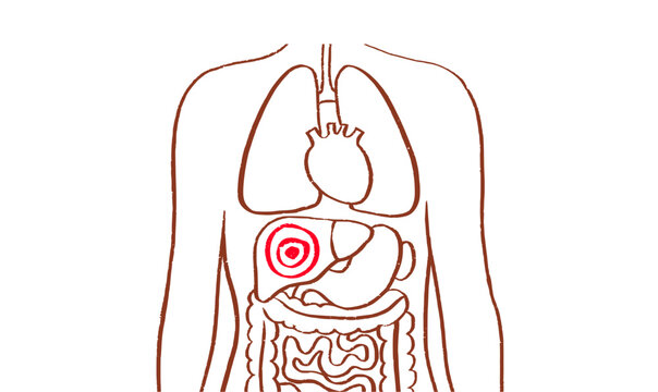 Liver disease concept