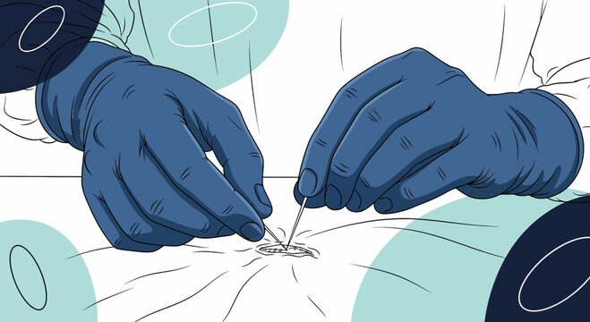 Detailed illustration depicting gloved hands performing a surgical procedure skillfully with