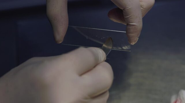 Professional veterinarian wearing sterile gloves carefully prepares a cytological smear from a cat on a glass microscope slide for laboratory analysis after a biopsy procedure.
