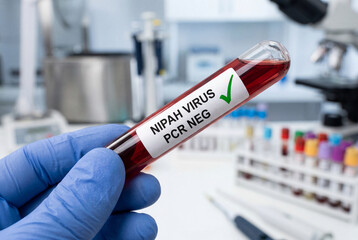 Naklejka premium A gloved hand holds a blood sample tube displaying a negative test result for a viral infection
