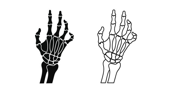 Two skeletal hand x rays displayed in black a stark visual silhouette