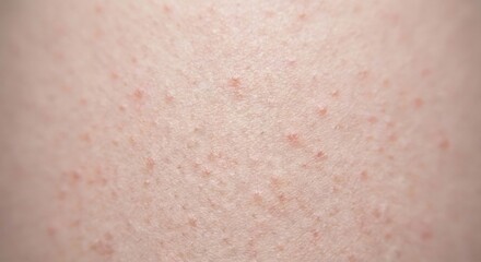 Fototapeta premium Macro view of skin texture with keratosis pilaris