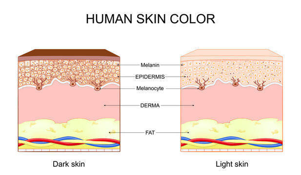 Human skin color. Different between Light and Dark skin.