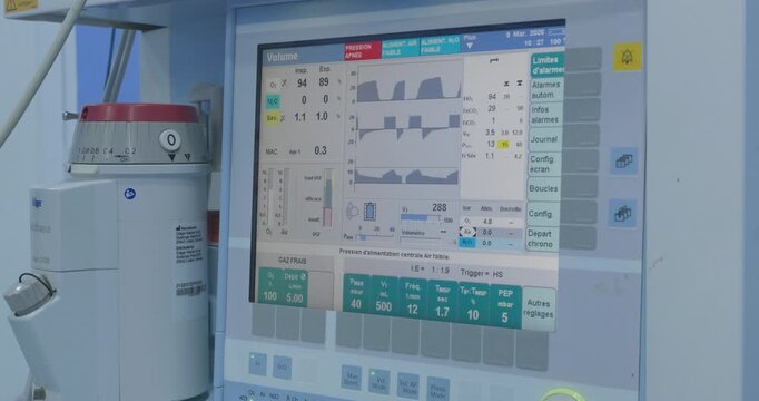 Close-up of a medical ventilator screen displaying real-time respiratory waveforms and patient vital signs in an intensive care unit (ICU).