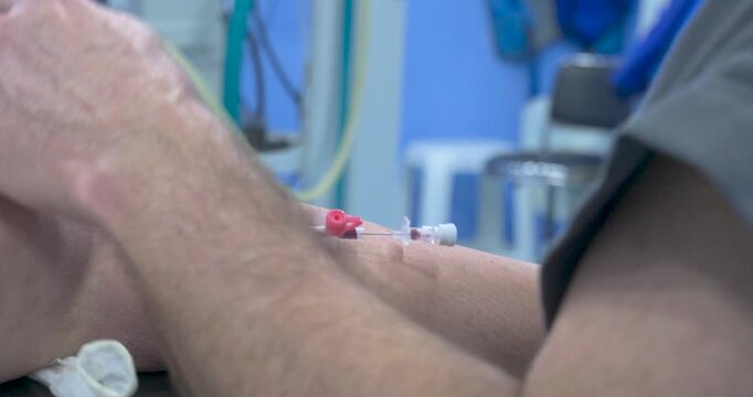 close-up of a healthcare provider inserting an intravenous (IV) catheter into a patient's arm in a clinical setting.