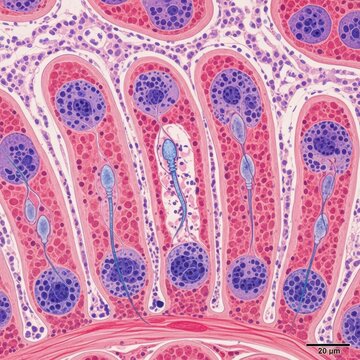 Microscopic view of spermatogenesis showing developing sperm cells within the testicular tissue