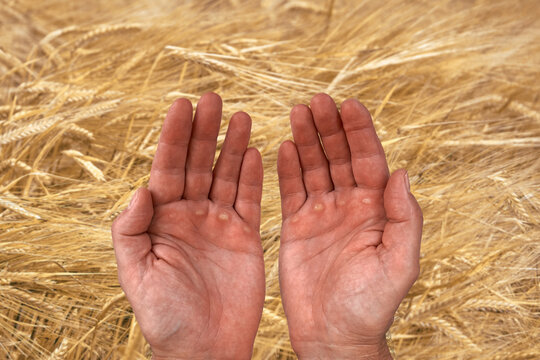 Close-up of rough working hands with calluses over ripe wheat field background. Concept of hard labor, farming, agriculture, harvest season, and manual work