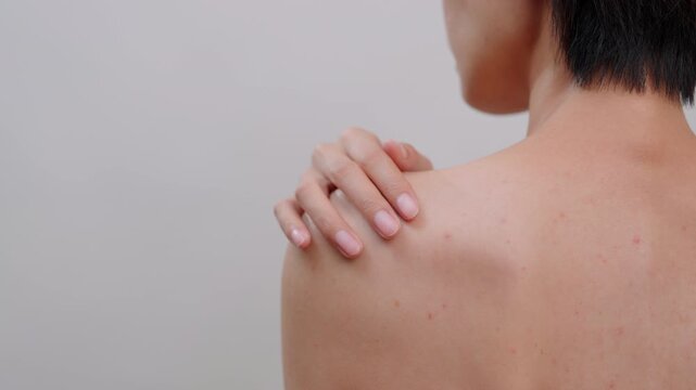 Close-up of asian female touching their shoulder, showing back acne, blemishes, and uneven skin tone. Ideal for dermatology, body skincare, and health concepts.
