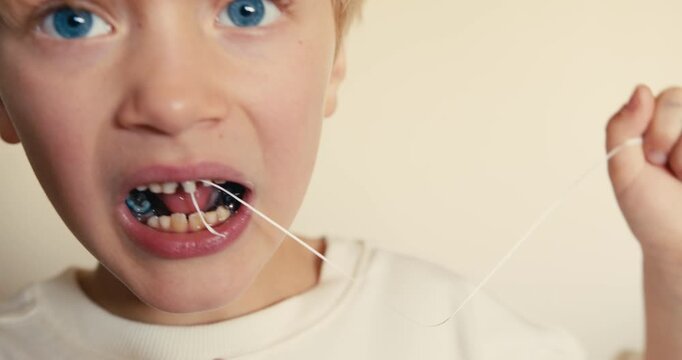 Close-up of a boy mouth with loose front teeth. He has tied a dental floss string to one of them to pull it out and is tugging on it.