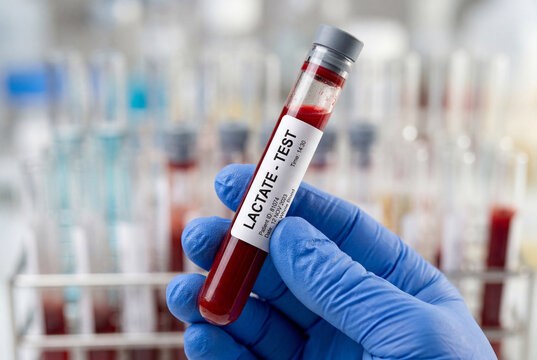 A gloved hand holds a blood sample test tube labeled for a lactate test in a laboratory