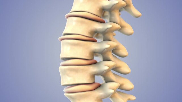 Lower Back Disc Herniation and Sciatica Pain