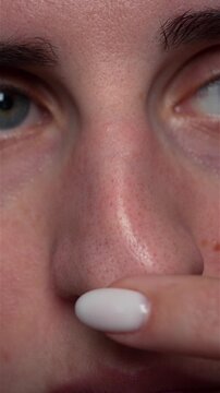 Close up of young woman applying skincare product on nose with visible blackheads and enlarged pores. Concept of facial care, pore treatment, beauty routine and skin problems.
