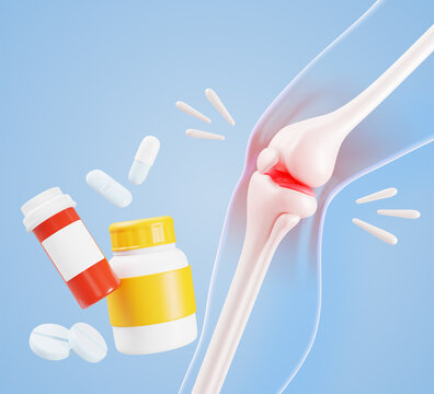 Knee anatomy 3D model with pill bottles, tablets, medicine drugs for inflammation and pain relief. Red glowing area indicates arthritis or injury. Vitamin or supplement capsules jar. 3D illustration
