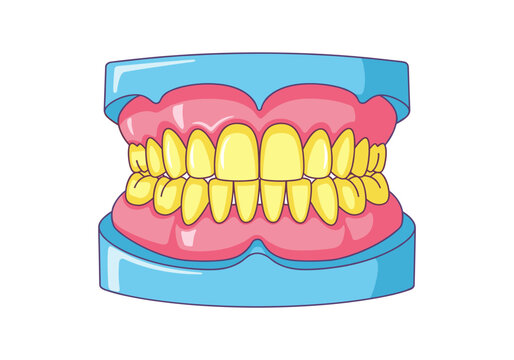 Cartoon illustration of a full set of yellow teeth on a dental model