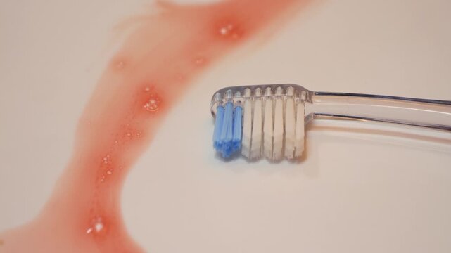 Close up of a toothbrush lying in a bathroom sink with traces of blood. Concept of dental issues, oral hygiene problems, and health concern. High quality 4k footage