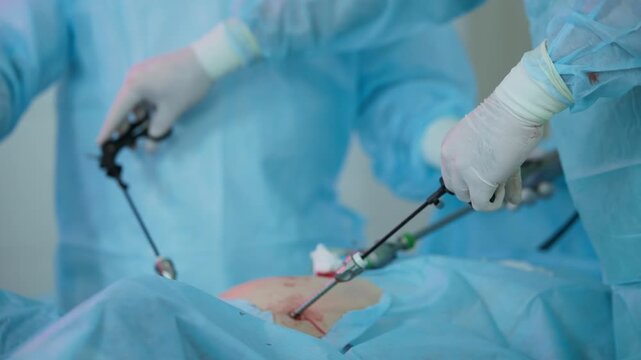 Tracking shot laparoscopic surgeons manipulating trocars and instruments over patient abdomen in hospital operating room during procedure.